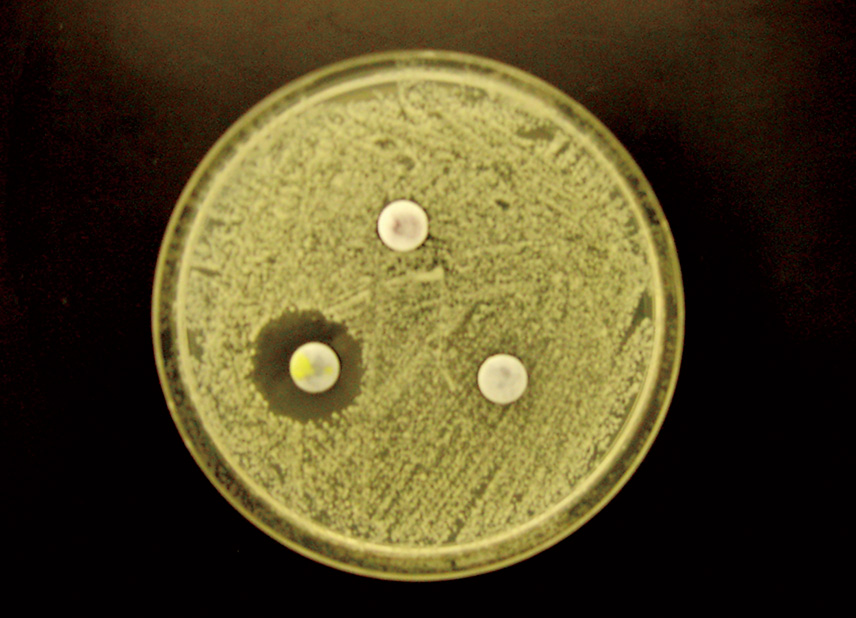 抗菌活性試験の写真